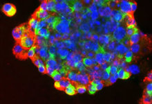 World’s first lab grown stem cells implanted