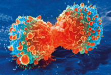 Cancer cells programmed back to normal by US scientists
